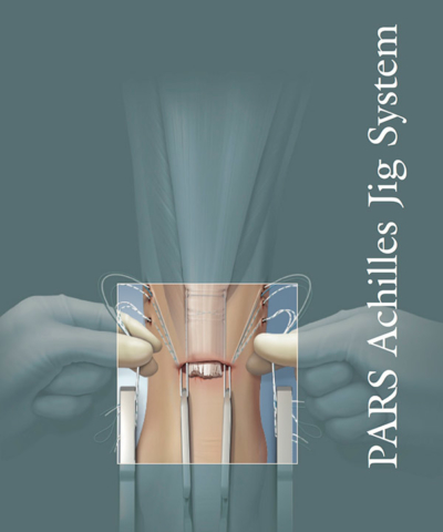 PARS Achilles Jig System to repair achilles tendon tear